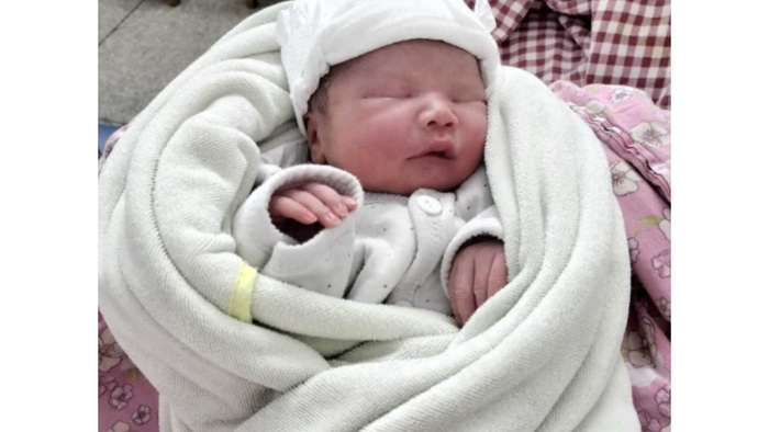 婴儿“头发多”和“头发少”，跟发育有关？爸妈别弄错