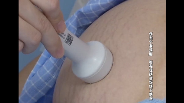 59岁女子产下4.4斤男婴，专家：不建议盲目效仿